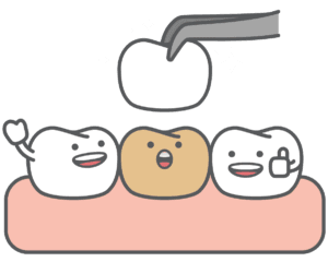 Cute illustration of cartoon teeth with one receiving a protective crown while others cheer happily – Tooth-Colored Baby Crowns.